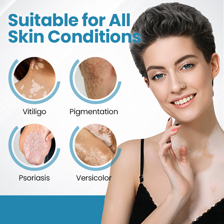 Bikenda® DermaBeam Vitiligo Therapy Device⏳Limited-time 49% off⏰💥