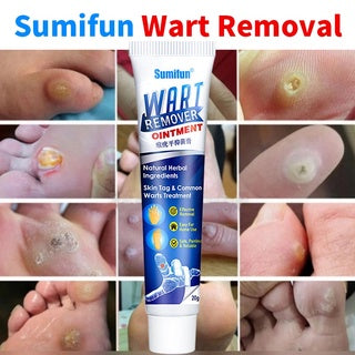 Herbal Wart Treatment Creamă3 Day Delivery&Cash on deliveryă