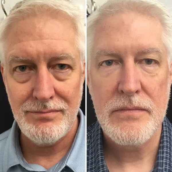 đAnti-wrinkle Magic Eye Cream