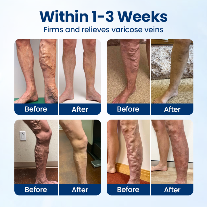 ⏳Limited-time 49% off⏰💥Timilk® VenoRelief Botanical Leg Spray