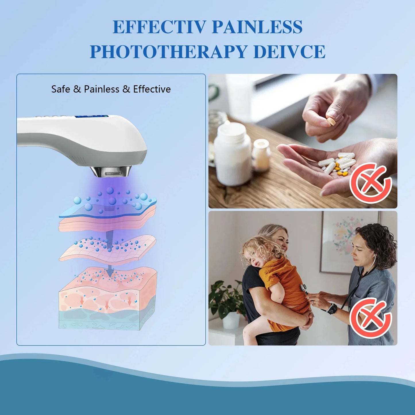 Handheld UVB Phototherapy Device for Vitiligo & Psoriasis - Portable 308nm Light Therapy Lamp by UVBtreatment⏳Limited-time 49% off⏰💥
