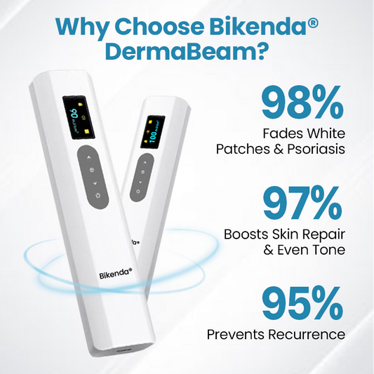 Bikenda® DermaBeam Vitiligo Therapy Device⏳Limited-time 49% off⏰💥