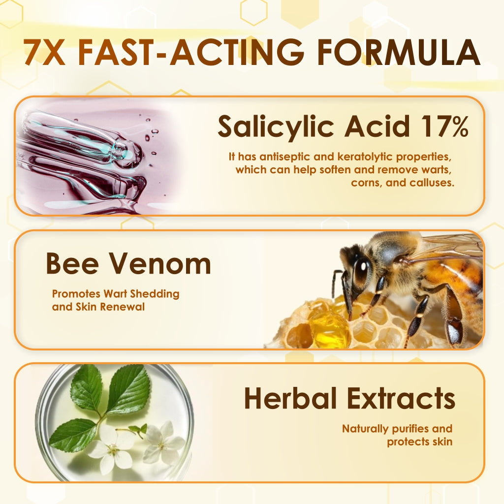 👓Best Selling 48% Off🔥Bee Venom Corn & Callus Remover Cream