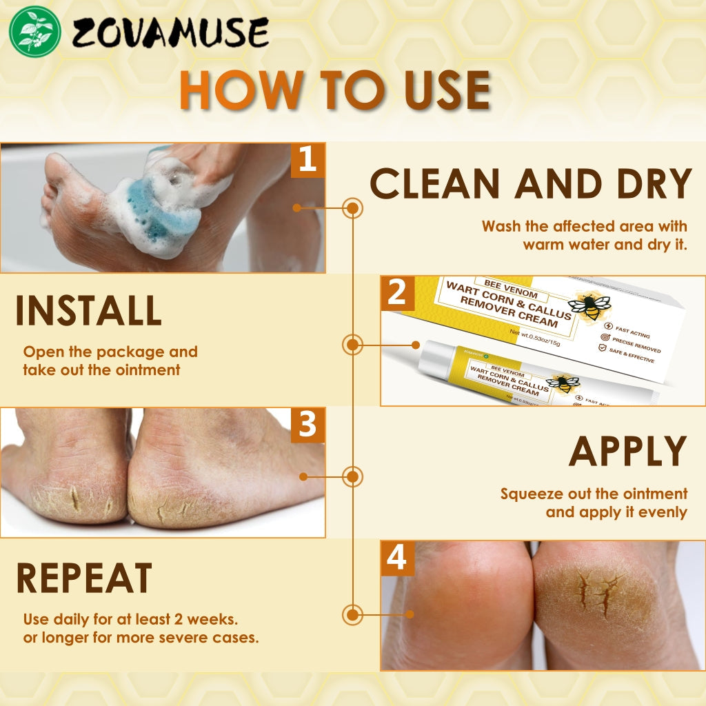 👓Best Selling 48% Off🔥Bee Venom Corn & Callus Remover Cream