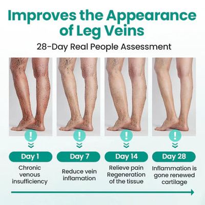 🔥LAOZIK™VARICOSE VEINS RELIEF PATCHES