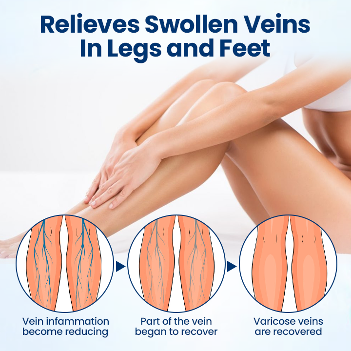 ⏳Limited-time 49% off⏰💥Timilk® VenoRelief Botanical Leg Spray