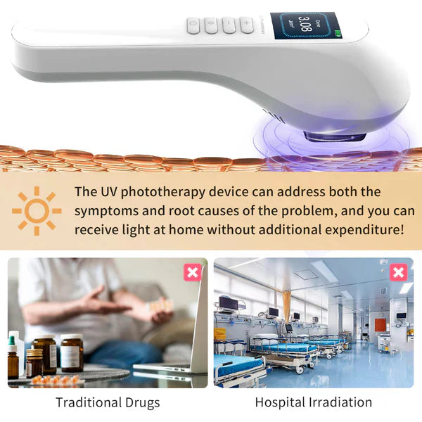 Handheld UVB Phototherapy Device for Vitiligo & Psoriasis - Portable 308nm Light Therapy Lamp by UVBtreatment⏳Limited-time 49% off⏰💥