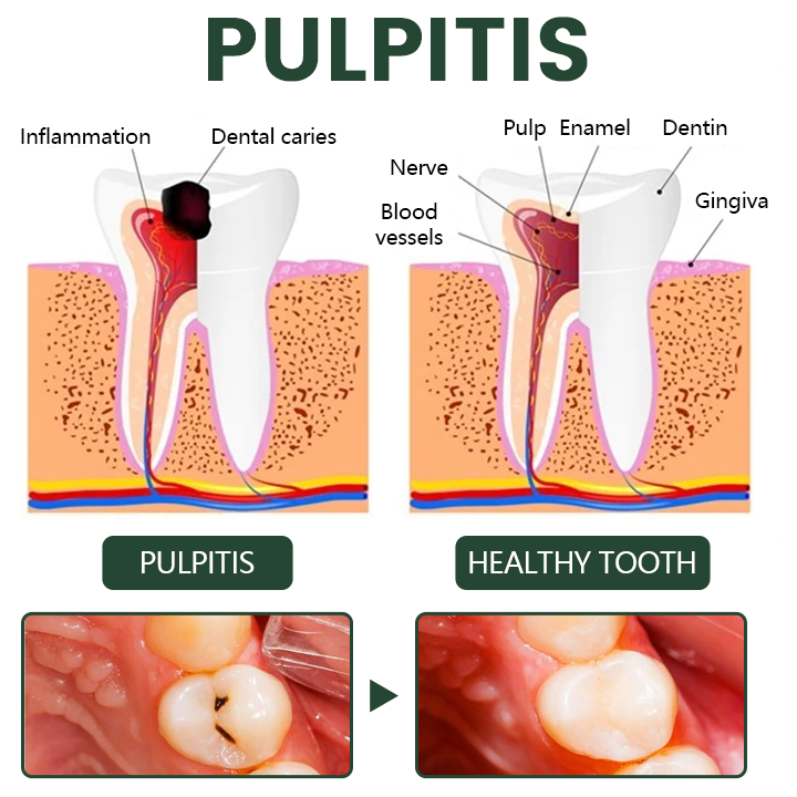 🦷Timilk® WillowBark Tooth Spray🛡️🌿 Multi-Repair for Dental problems🦷