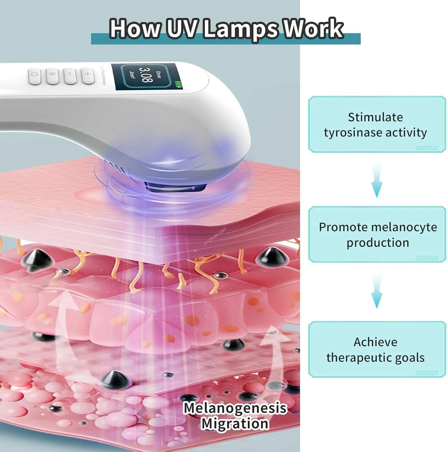 Handheld UVB Phototherapy Device for Vitiligo & Psoriasis - Portable 308nm Light Therapy Lamp by UVBtreatment⏳Limited-time 49% off⏰💥