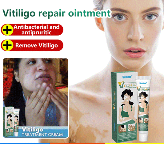 Sumifun®Vitiligo Treatment Ointment⏳Limited-time 48% off⏰💥